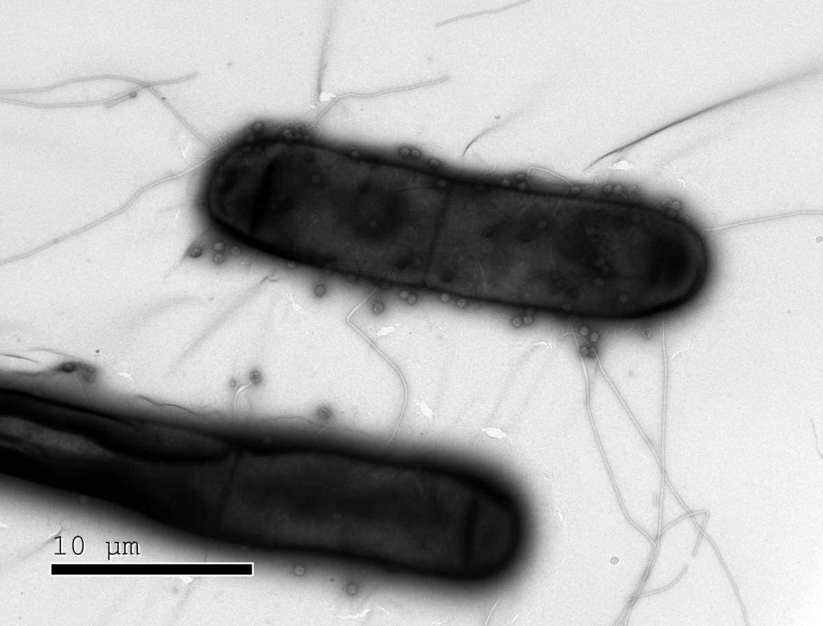 Bacterial Immune Systems Take the Stage